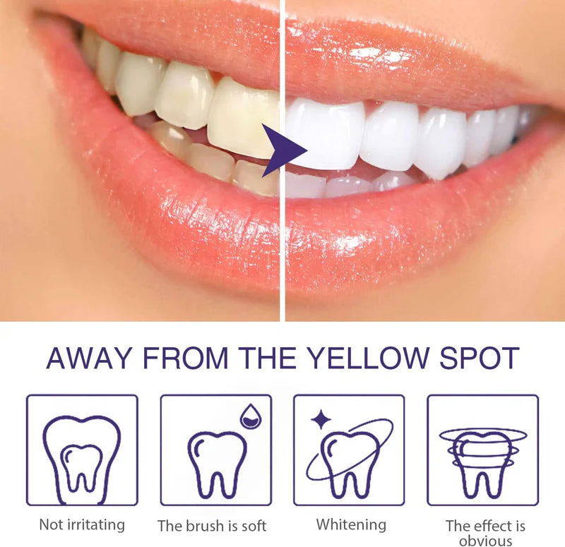 Lanthome V34 Teeth Whitening Pen